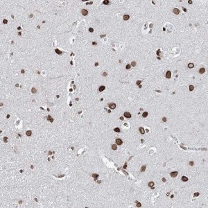 Anti-KIAA0930 antibody produced in rabbit 
