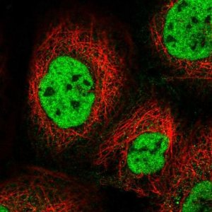 Anti-KIAA1191 antibody produced in rabbit 