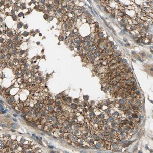Anti-KIAA1217 antibody produced in rabbit 