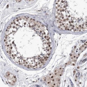 Anti-KIAA1429 antibody produced in rabbit 