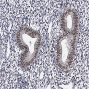 Anti-KIAA1429 antibody produced in rabbit 