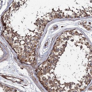 Anti-KIAA1524 antibody produced in rabbit 
