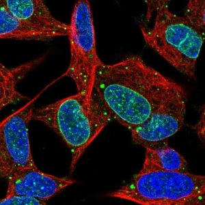 Anti-KIAA1614 antibody produced in rabbit HPA061684-100UL