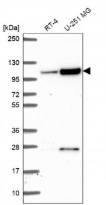 Anti-KIAA1614 antibody produced in rabbit HPA061684-100UL