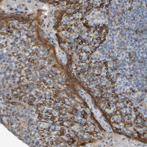 Anti-KIAA1671 antibody produced in rabbit 
