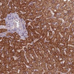 Anti-KIAA1841 antibody produced in rabbit 