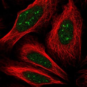 Anti-KIAA1841 antibody produced in rabbit 