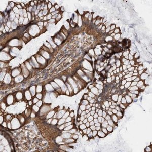 Anti-KIF12 antibody produced in rabbit 