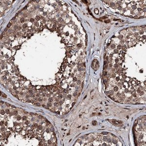 Anti-KIF18A antibody produced in rabbit 