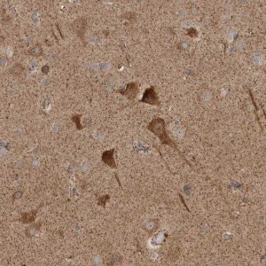 Anti-KIF21B antibody produced in rabbit 