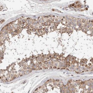 Anti-KIF21B antibody produced in rabbit 
