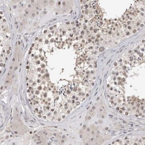 Anti-KIF2B antibody produced in rabbit 