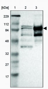 Anti-KIF2C antibody produced in rabbit HPA006432-100UL