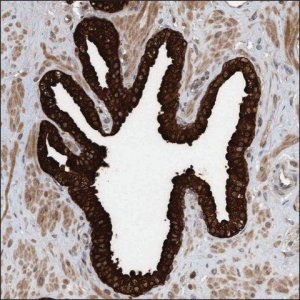 Anti-KL antibody produced in rabbit HPA023480-100UL