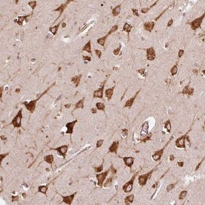 Anti-KLC1 antibody produced in rabbit 