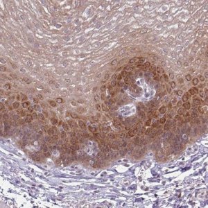 Anti-KLC3 antibody produced in rabbit 