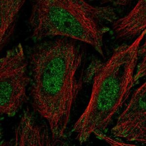 Anti-KLF11 antibody produced in rabbit 