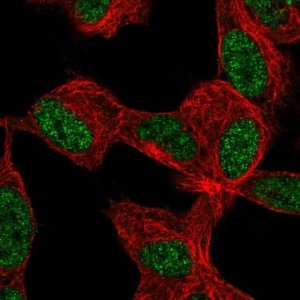 Anti-KLF12 antibody produced in rabbit 