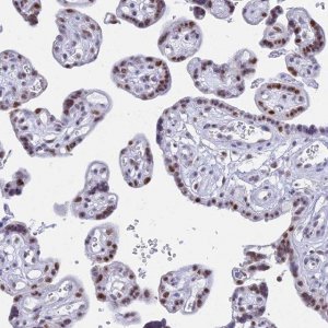 Anti-KLF14 antibody produced in rabbit 