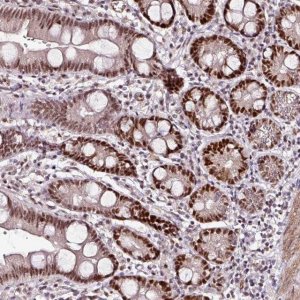 Anti-KLF16 antibody produced in rabbit 