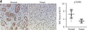 Anti-KLF5 antibody produced in rabbit 