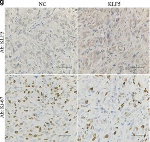 Anti-KLF5 antibody produced in rabbit 