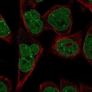 Anti-KLHDC2 antibody produced in rabbit 