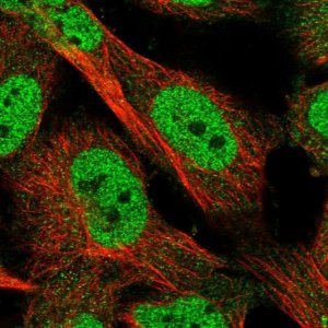 Anti-KLHDC3 antibody produced in rabbit 
