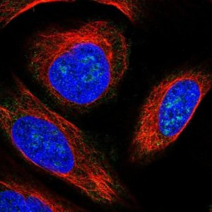 Anti-KLHDC4 antibody produced in rabbit 