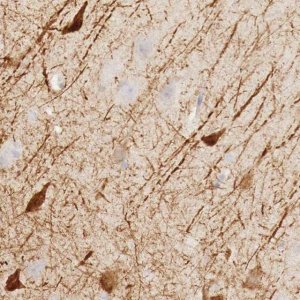 Anti-KLHDC7B antibody produced in rabbit 