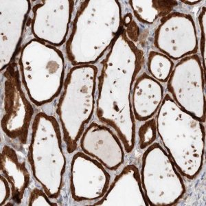 Anti-KLHL14 antibody produced in rabbit 