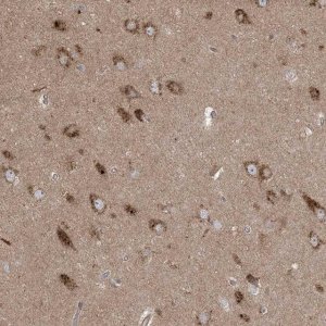 Anti-KLHL18 antibody produced in rabbit 