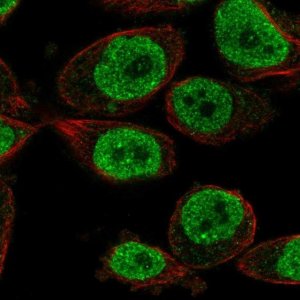 Anti-KLHL18 antibody produced in rabbit 
