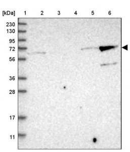Anti-KLHL26 antibody produced in rabbit 
