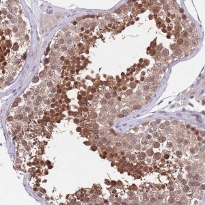Anti-KLHL29 antibody produced in rabbit HPA049057-100UL