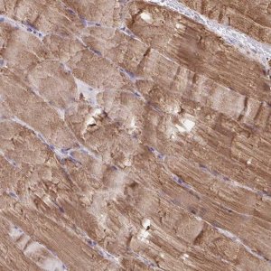 Anti-KLHL34 antibody produced in rabbit 