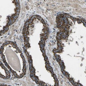 Anti-KLHL5 antibody produced in rabbit HPA013958-100UL