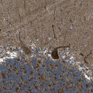 Anti-KLHL5 antibody produced in rabbit HPA013958-100UL