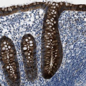 Anti-KLHL8 antibody produced in rabbit 