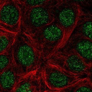 Anti-KLLN antibody produced in rabbit 