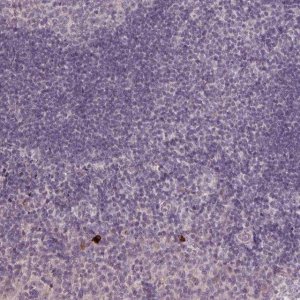 Anti-KLRC3 antibody produced in rabbit 