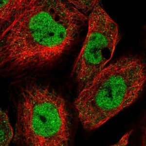 Anti-KMT2A antibody produced in rabbit 
