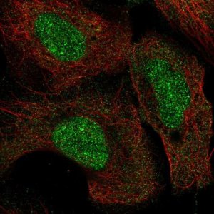 Anti-KMT5A antibody produced in rabbit 