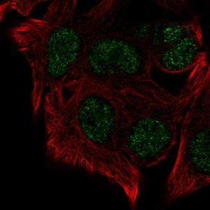 Anti-KMT5B antibody produced in rabbit 