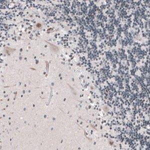 Anti-KMT5C antibody produced in rabbit 