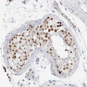 Anti-KNL1 antibody produced in rabbit 