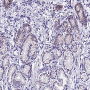 Anti-KNOP1 antibody produced in rabbit HPA041079-100UL