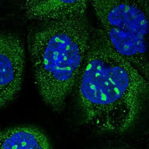 Anti-KNOP1 antibody produced in rabbit HPA041079-100UL
