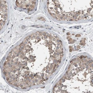 Anti-KNTC1 antibody produced in rabbit 