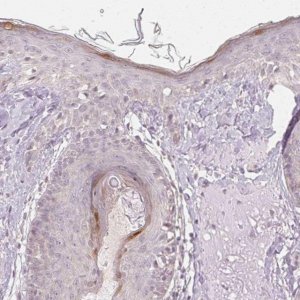 Anti-KPRP antibody produced in rabbit 